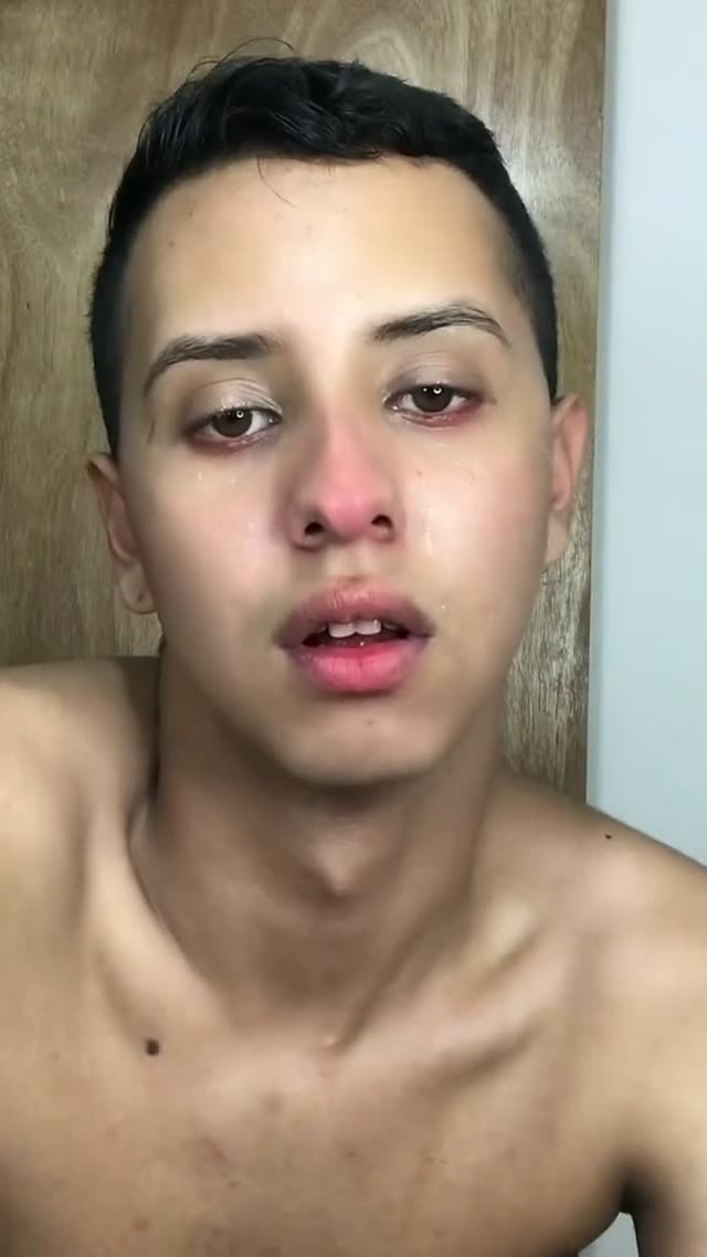 before/after🏳️‍🌈+ویدیو