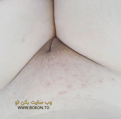 عکس سکسی ایرانی 3acf9f47
