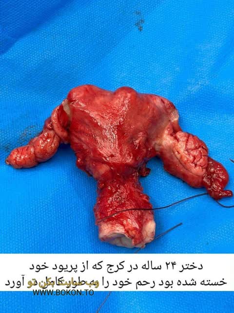 عکس سکسی ایرانی 860f7493