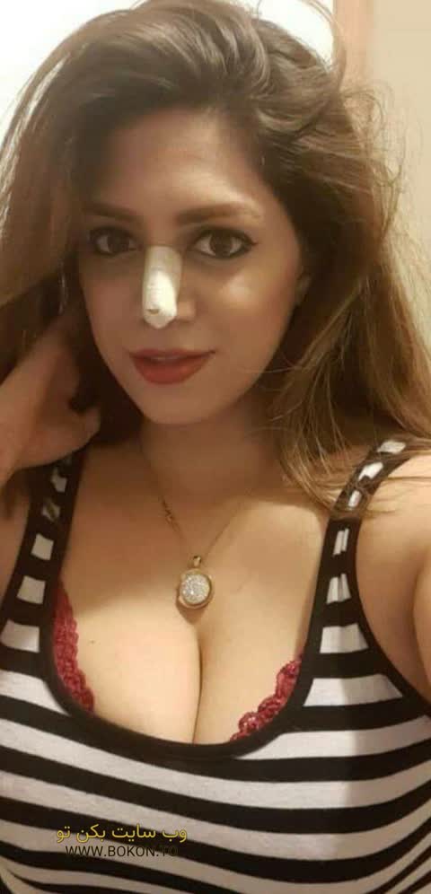 عکس سکسی ایرانی bd468681