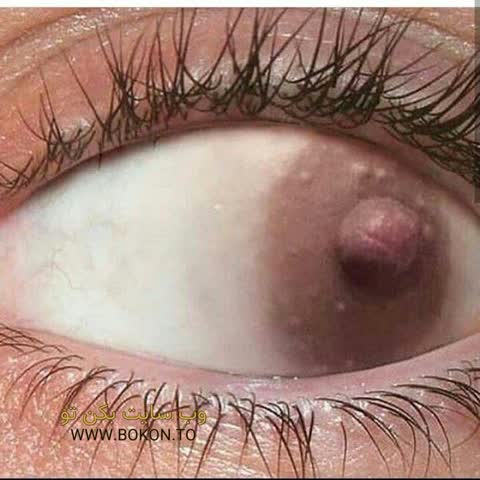 عکس سکسی ایرانی fae4b264