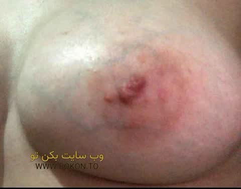 عکس سکسی ایرانی a059cd41